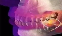 爆料小孩长智齿视频,萌态可掬引网友热议