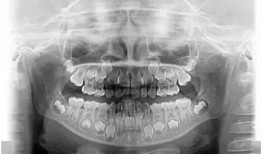 爆料小孩长智齿视频,萌态可掬引网友热议